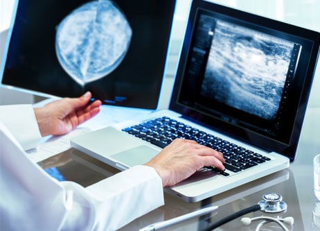 Aerztin schaut sich Bilder einer kontrastmittelgestuetzten Mammographie auf einem Computer an