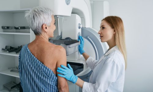 Eine ältere Frau bei der konstrastmittelgestützten Mammographie